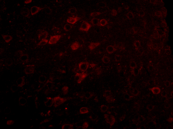 Immunocytochemistry/ Immunofluorescence: LASS6 Antibody - BSA Free [NBP1-76965] - Immunofluorescence of LASS6 in Mouse Brain cells with LASS6 antibody at 5 ug/mL.