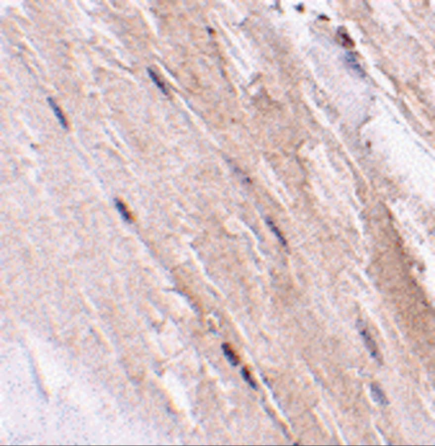 Immunohistochemistry: GBAS Antibody - BSA Free [NBP1-76966] - Immunohistochemistry of GBAS in mouse skeletal muscle tissue with GBAS antibody at 2.5ug/mL.
