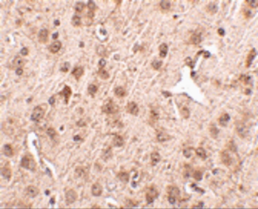 Immunohistochemistry NIPSNAP3A Antibody - BSA Free