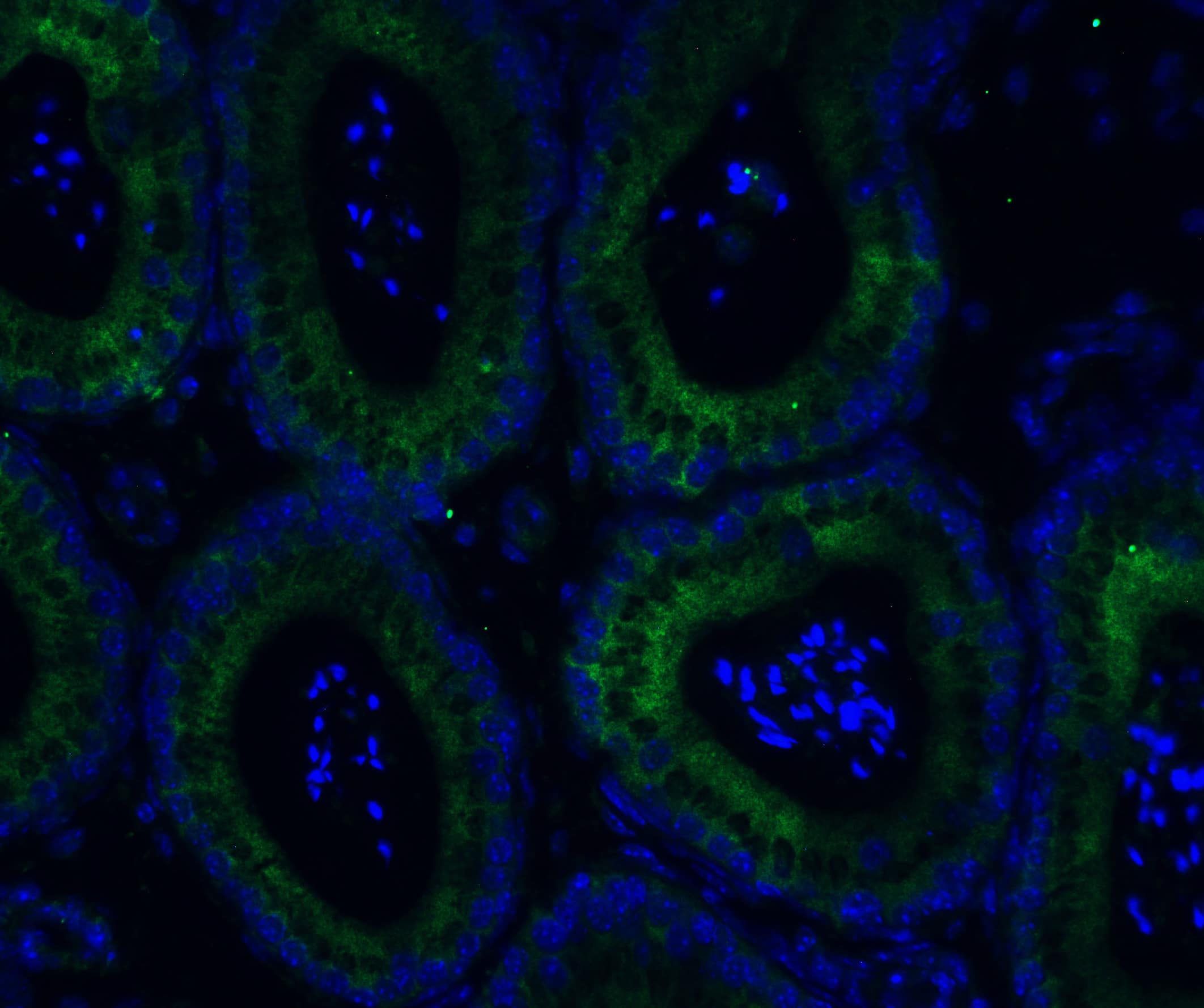 Immunocytochemistry/ Immunofluorescence: ADAM10 Antibody - BSA Free [NBP1-76973] - Figure  9 Immunofluorescence Validation of ADAM10 in Mouse TestisImmunofluorescent analysis of 4% paraformaldehyde-fixed mouse testis labeling ADAM10 with  at 20 u/mL, followed by goat anti-rabbit IgG secondary antibody at 1/500 dilution (green) and DAPI staining (blue).