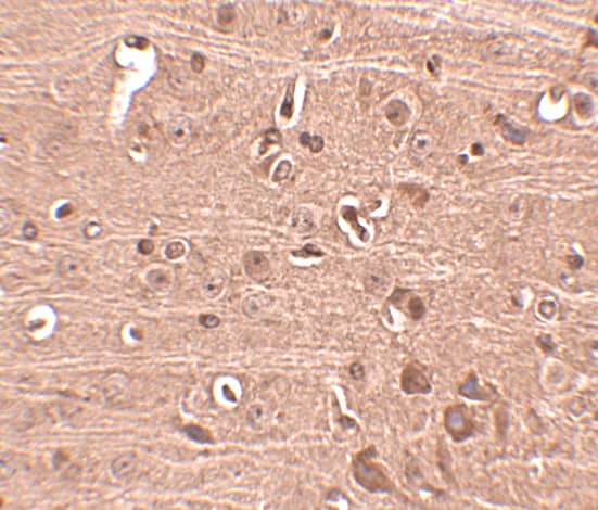 Immunohistochemistry GLE1 Antibody - BSA Free