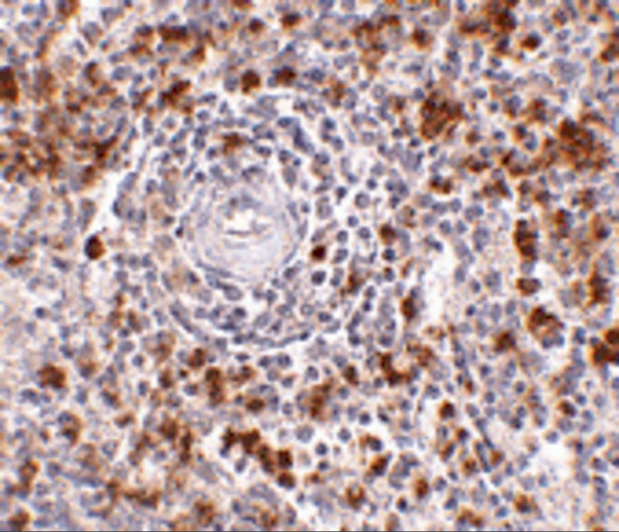 Immunohistochemistry: EBI3 Antibody - BSA Free [NBP1-76976] - Validation of EBI-3 in Human Spleen Tissue. Immunohistochemical analysis of paraffin-embedded Human Spleen tissue using anti-EBI-3 antibody  at 2.5 ug/ml. Tissue was fixed with formaldehyde and blocked with 10% serum for 1 h at RT; antigen retrieval was by heat mediation with a citrate buffer (pH6). Samples were incubated with primary antibody overnight at 4C. A goat anti-rabbit IgG H&L (HRP) at 1/250 was used as secondary. Counter stained with Hematoxylin.