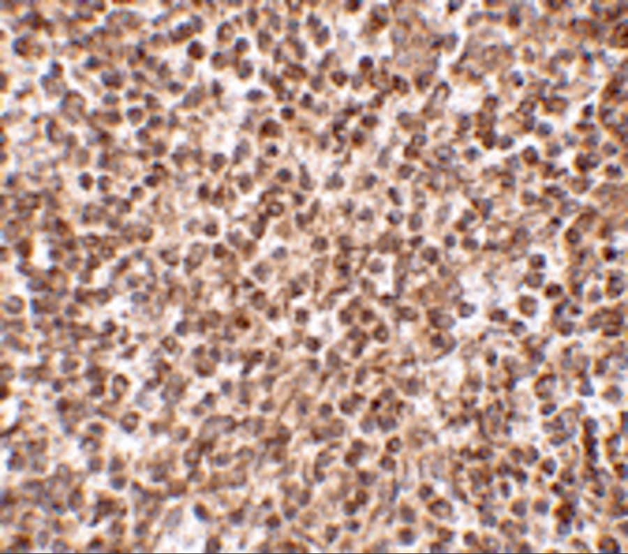 Immunohistochemistry: TREX1 Antibody - BSA Free [NBP1-76977] - Immunohistochemistry of TREX1 in human spleen tissue with TREX1 antibody at 2.5 u/mL.