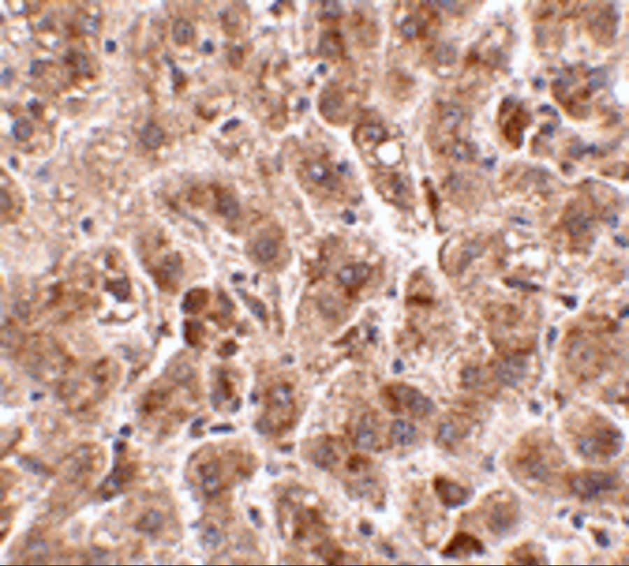 Immunohistochemistry TREX2 Antibody - BSA Free