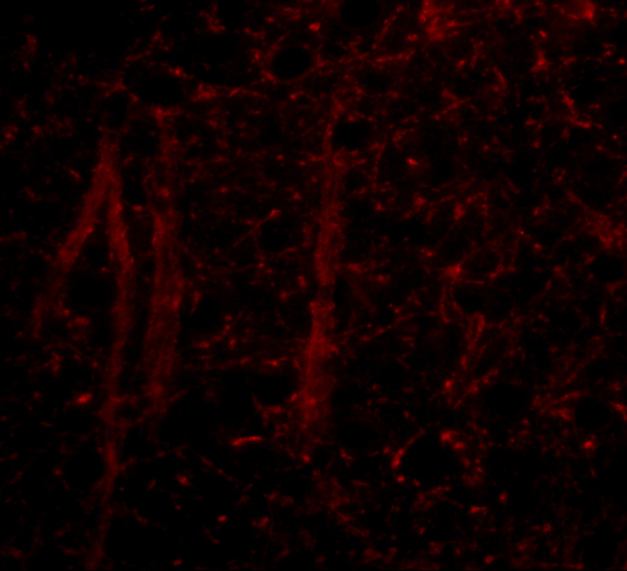 Immunocytochemistry/ Immunofluorescence: GLE1 Antibody - BSA Free [NBP1-76979] - Immunofluorescence of gle1 in mouse brain tissue with gle1 antibody at 20 u/mL.