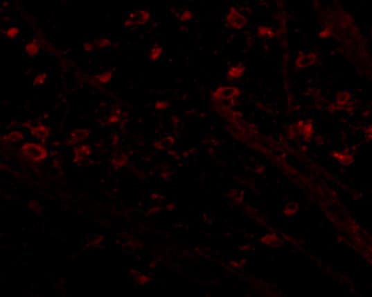 Immunocytochemistry/ Immunofluorescence: CRMP1 Antibody - BSA Free [NBP1-76982] - Immunofluorescence of CRMP1 in mouse brain tissue with CRMP1 antibody at 5 ug/mL.