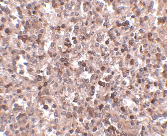 Immunohistochemistry: KLRA1 Antibody - BSA Free [NBP1-76983] - Immunohistochemistry of KLRA1 in human spleen tissue with KLRA1 antibody at 2.5 ug/mL.