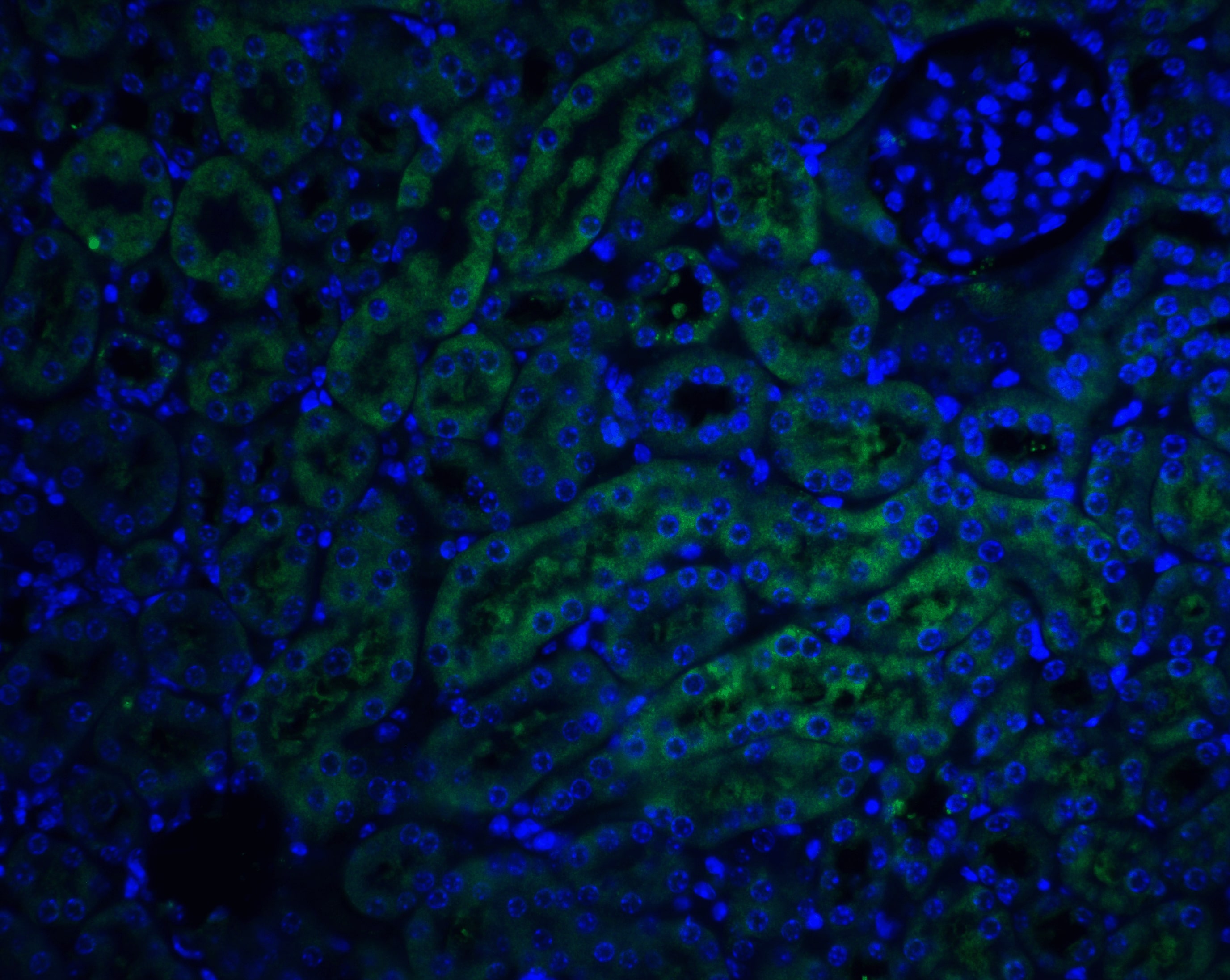 Immunocytochemistry/ Immunofluorescence TRAILR4/TNFRSF10D/DcR2 Antibody - BSA Free