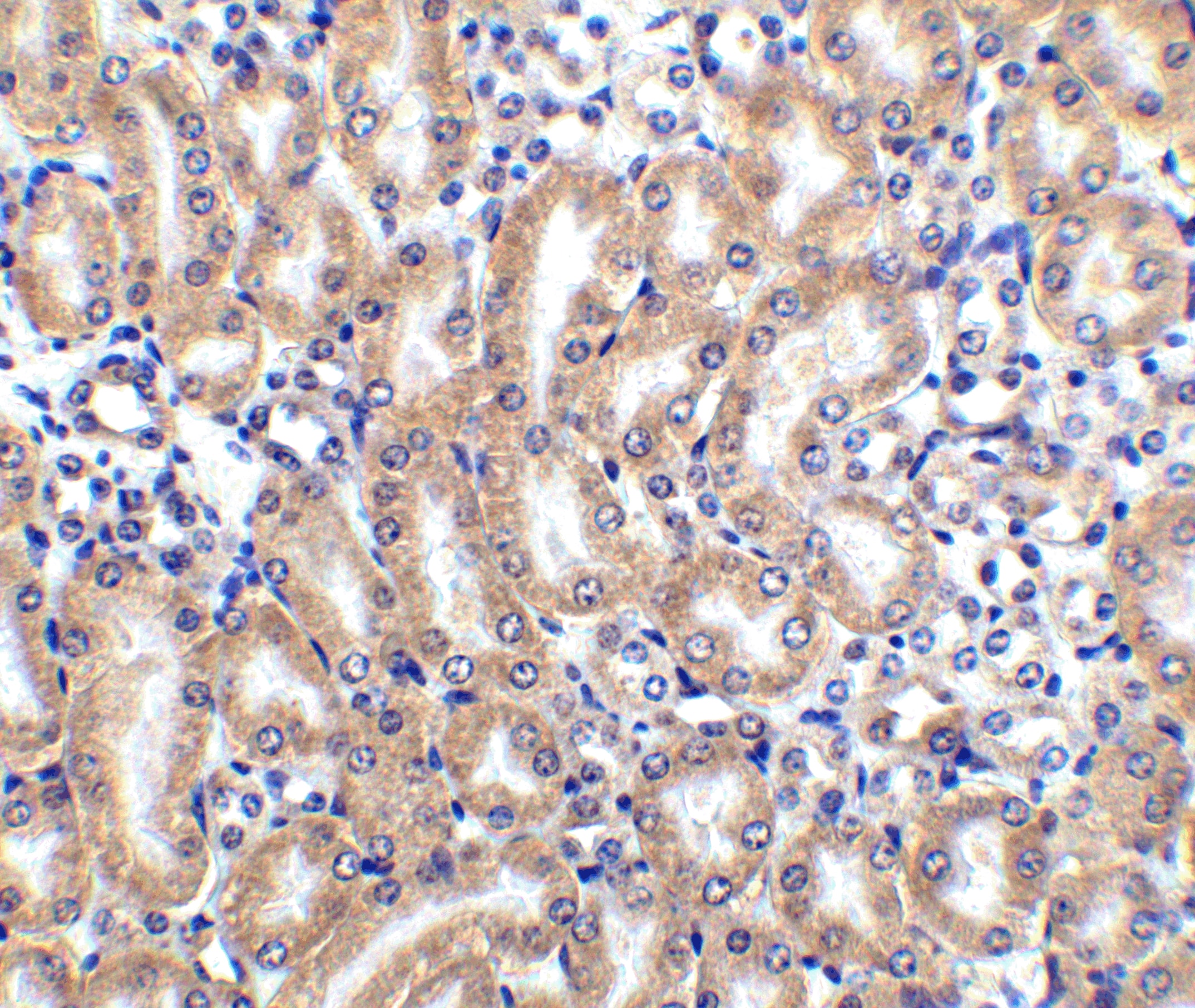 Immunohistochemistry: TRAILR4/TNFRSF10D/DcR2 Antibody - BSA Free [NBP1-76985] - Immunohistochemistry of TRAILR4/TNFRSF10D/DcR2 in mouse kidney node tissue with TRAILR4/TNFRSF10D/DcR2 antibody at 2.5 ug/ml.