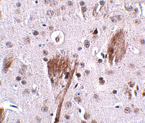 Immunohistochemistry SPG11 Antibody - BSA Free