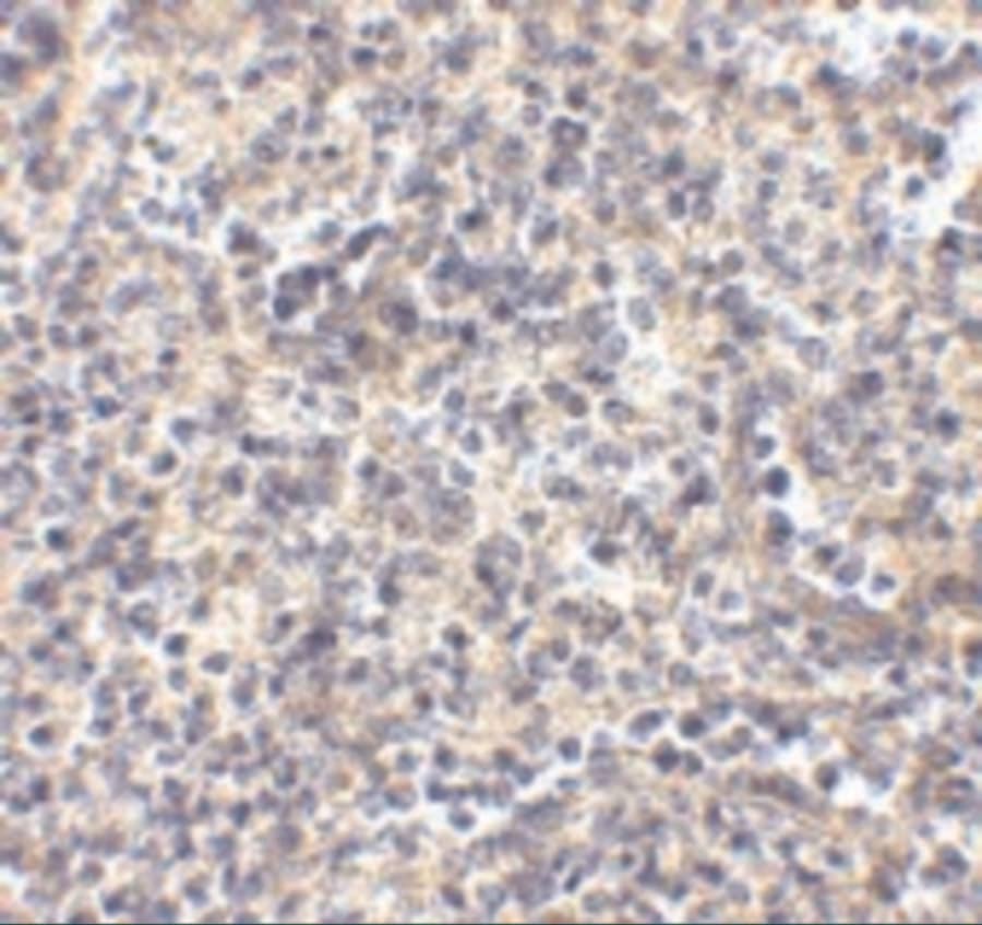 Immunohistochemistry: ATG5 Antibody - BSA Free [NBP1-76992] - Figure 4 Immunohistochemistry Validation of ATG5 in Human Spleen Immunohistochemical analysis of paraffin-embedded human spleen tissue using anti-ATG5 antibody  at 2.5 u/ml. Tissue was fixed with formaldehyde and blocked with 10% serum for 1 h at RT; antigen retrieval was by heat mediation with a citrate buffer (pH6). Samples were incubated with primary antibody overnight at 4C. A goat anti-chicken IgG H&L (HRP) at 1/250 was used as secondary. Counter stained with Hematoxylin.