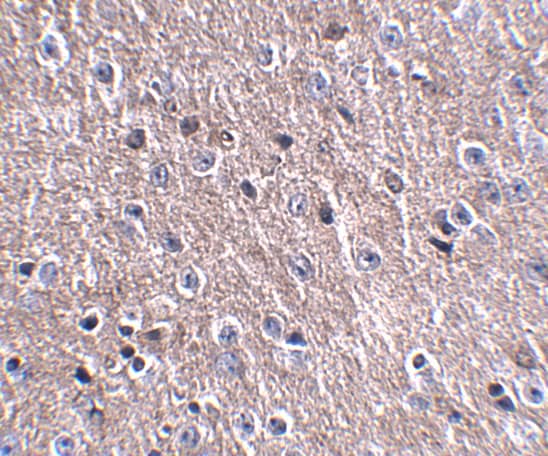 Immunohistochemistry: CDIP Antibody - BSA Free [NBP1-76993] - Immunohistochemistry of FNIP2 in mouse brain tissue with FNIP2 antibody at 2.5 ug/mL.