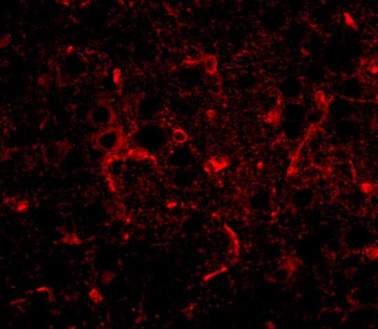 Immunocytochemistry/ Immunofluorescence: CDIP Antibody - BSA Free [NBP1-76993] - Immunofluorescence of CDIP1 in mouse brain tissue with CDIP1 antibody at 20 ug/mL.