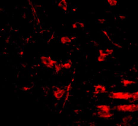 Immunocytochemistry/ Immunofluorescence RCAN2 Antibody - BSA Free