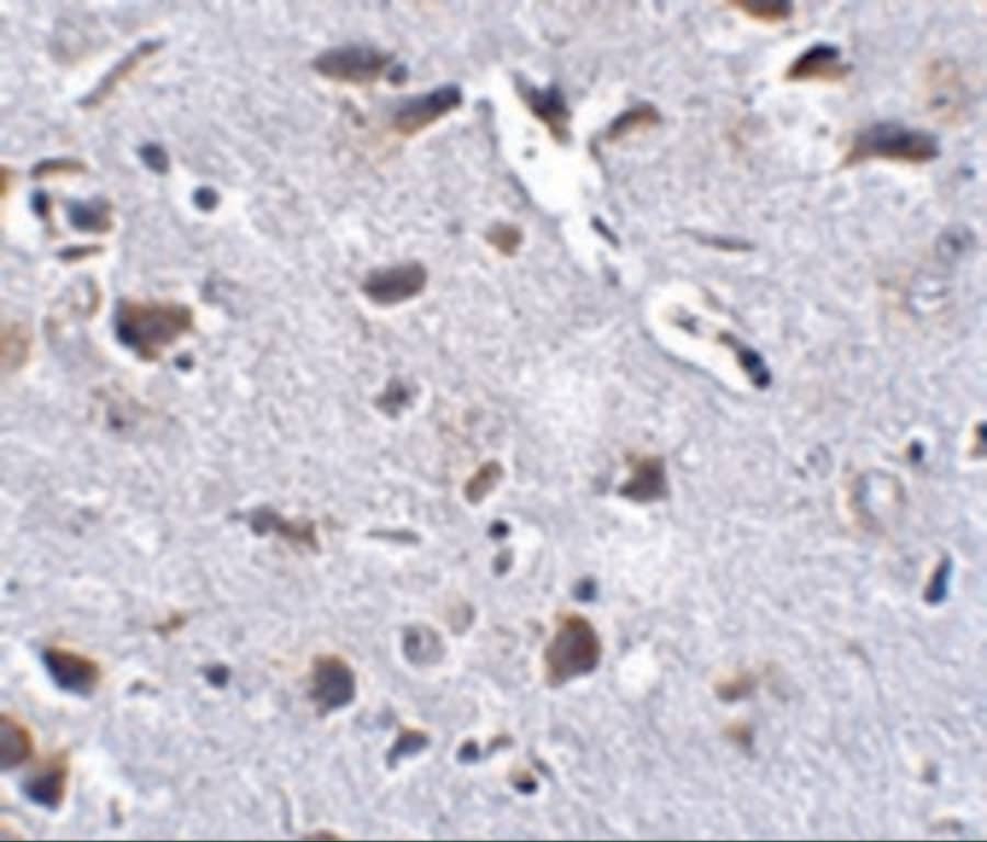 Immunohistochemistry RCAN2 Antibody - BSA Free