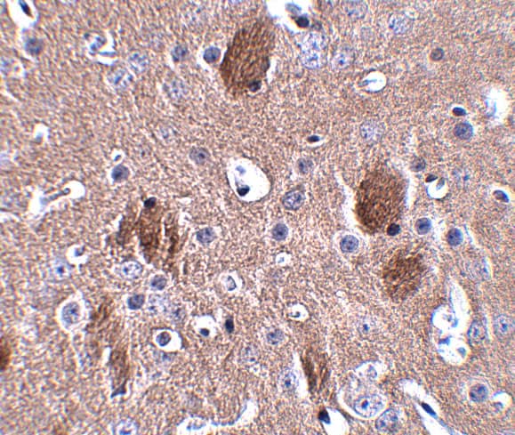 Immunohistochemistry CDIP Antibody - BSA Free