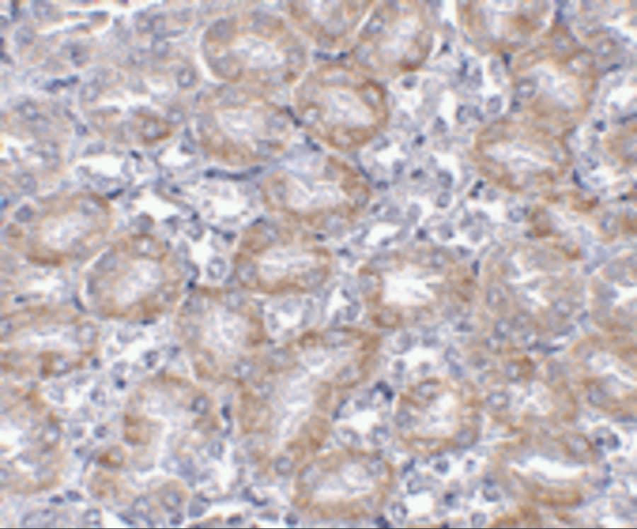 Immunohistochemistry MTCH2 Antibody - BSA Free