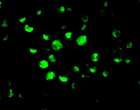 Immunocytochemistry/ Immunofluorescence: APAF-1 Antibody - BSA Free [NBP1-77000] - Immunofluorescence of APAF-1 in K562 cells with APAF-1 antibody at 10 u/mL.