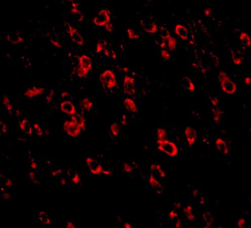 Immunocytochemistry/ Immunofluorescence Protocadherin-18 Antibody - BSA Free