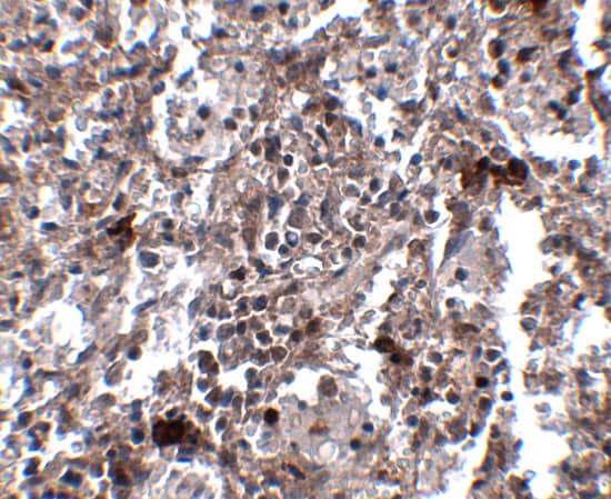 Immunohistochemistry KCTD15 Antibody - BSA Free