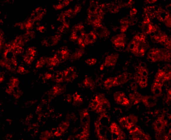 Immunocytochemistry/ Immunofluorescence: Apolipoprotein A-I/ApoA1 Antibody - BSA Free [NBP1-77008] - Immunofluorescence of Apolipoprotein A-I/ApoA1 in human liver tissue with Apolipoprotein A-I/ApoA1 antibody at 20 ug/mL.