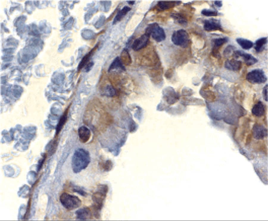 Immunohistochemistry DFF45/ICAD Antibody - BSA Free