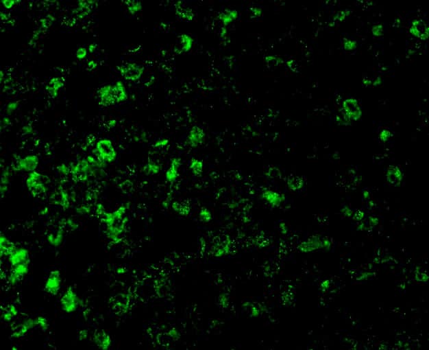 Immunocytochemistry/ Immunofluorescence: DFF45/ICAD Antibody - BSA Free [NBP1-77010] - Immunofluorescence of DFF45/ICAD in Mouse Lung cells with DFF45/ICAD antibody at 10 u/mL.