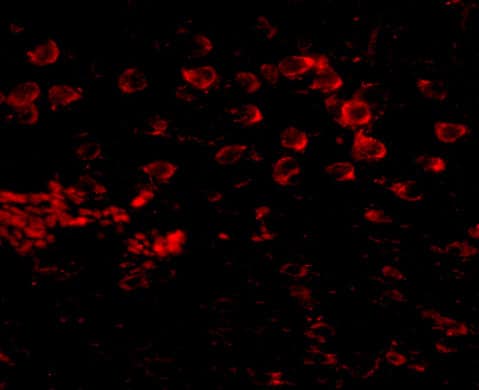 Immunocytochemistry/ Immunofluorescence Matrilin-4 Antibody - BSA Free