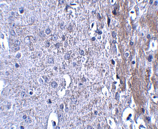 Immunohistochemistry: Matrilin-4 Antibody - BSA Free [NBP1-77012] - Immunohistochemistry of Matrilin-4 in mouse brain tissue with Matrilin-4 antibody at 2.5 u/mL.