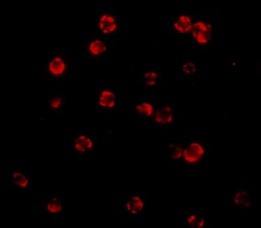 Immunocytochemistry/ Immunofluorescence: FLIP Antibody - BSA Free [NBP1-77016] - Immunofluorescence of FLIP in HeLa cells with FLIP antibody at 20 u/mL.