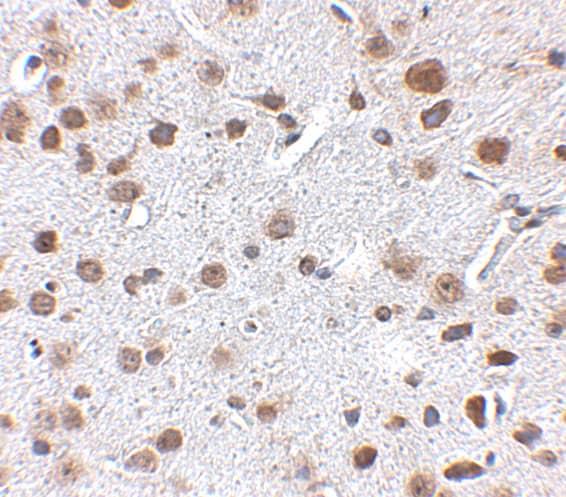 Immunohistochemistry FTO Antibody - BSA Free