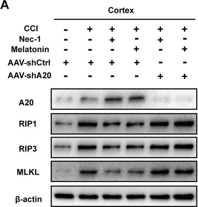 AAV-shA20 attenuated the anti-necroptotic roles of Nec-1 and melatonin and recovered the RAGE/NF-kappa B pathway. (A,B) In the cortex tissues, AAV-shA20 inhibited the effect of Nec-1 and melatonin on RIP1, RIP3 and MLKL, determined by immunoblotting and immunohistochemistry.  beta -actin was used as a control. (C,D) The same results were demonstrated in hippocampal CA1 tissues. (E,F) Restored RAGE and active NF-kappa B pathway were detected in cortex tissues by immunoblotting after AAV-shA20 administration. The same results were demonstrated in hippocampal CA1 tissues.  beta -actin was used as a control. Image collected and cropped by CiteAb from the following open publication (//pubmed.ncbi.nlm.nih.gov/31607859), licensed under a CC-BY license. Not internally tested by Novus Biologicals.