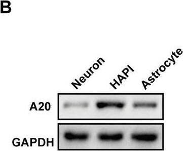 A20 downregulation promoted necroptosis in vitro. (A) Primary neuron and astrocyte were obtained and verified in relative antibody. (B) A20 protein expression in primary neuron, primary astrocyte and HAPI. (C) Relative mRNA expression of A20 in different cell types was obtained from a database of Stanford University (//web.stanford.edu/group/barres_lab/brain_rnaseq.html). (D) A20 was significantly decreased after si-A20 treatment in the three cell types, including primary neuron, primary astrocyte and HAPI. (E,F) Tumor necrosis factor (TNF)-alpha  (10 ng/ml) + Z-VAD (100 μm) combination (TZ) as a necroptosis inducer was used for 24 h. In primary neuron, RIP1, RIP3 and MLKL were tested by western blot. Data were analyzed by statistical. (G,H) TUNEL assays and (I) CCK-8 (n = 4) were used to test cell death and viability of neuron after 24 h treatment. (J–M) Western blot assay was used to test RIP1, RIP3, MLKL, NF-KB and relative inflammatory factors in primary HAPI and astrocyte respectively. Data were measured by one way ANOVA plus Tukey’s test. *P < 0.05 and **P < 0.01 vs. TZ group; #P < 0.05 and ##P < 0.01 vs. TZ+si-NC group. Image collected and cropped by CiteAb from the following open publication (//pubmed.ncbi.nlm.nih.gov/31607859), licensed under a CC-BY license. Not internally tested by Novus Biologicals.