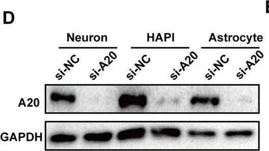 A20 downregulation promoted necroptosis in vitro. (A) Primary neuron and astrocyte were obtained and verified in relative antibody. (B) A20 protein expression in primary neuron, primary astrocyte and HAPI. (C) Relative mRNA expression of A20 in different cell types was obtained from a database of Stanford University (//web.stanford.edu/group/barres_lab/brain_rnaseq.html). (D) A20 was significantly decreased after si-A20 treatment in the three cell types, including primary neuron, primary astrocyte and HAPI. (E,F) Tumor necrosis factor (TNF)-alpha  (10 ng/ml) + Z-VAD (100 μm) combination (TZ) as a necroptosis inducer was used for 24 h. In primary neuron, RIP1, RIP3 and MLKL were tested by western blot. Data were analyzed by statistical. (G,H) TUNEL assays and (I) CCK-8 (n = 4) were used to test cell death and viability of neuron after 24 h treatment. (J–M) Western blot assay was used to test RIP1, RIP3, MLKL, NF-KB and relative inflammatory factors in primary HAPI and astrocyte respectively. Data were measured by one way ANOVA plus Tukey’s test. *P < 0.05 and **P < 0.01 vs. TZ group; #P < 0.05 and ##P < 0.01 vs. TZ+si-NC group. Image collected and cropped by CiteAb from the following open publication (//pubmed.ncbi.nlm.nih.gov/31607859), licensed under a CC-BY license. Not internally tested by Novus Biologicals.