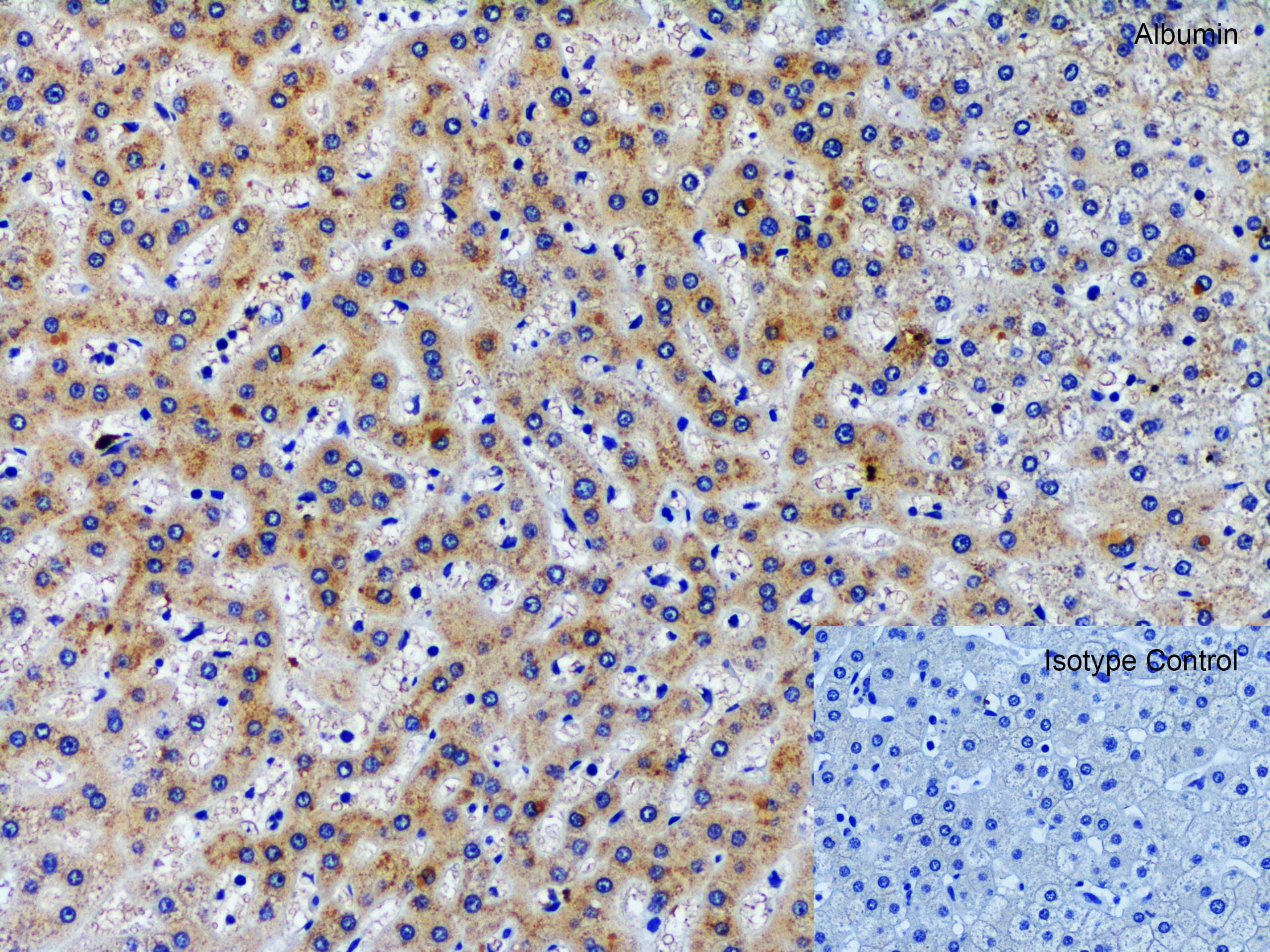 Immunohistochemistry: Albumin Antibody - BSA Free [NBP1-77027] - Validation of Albumin in Human Liver.Immunohistochemical analysis of paraffin-embedded human liver tissue using anti-albumin antibody at 2 u/ml. Tissue was fixed with formaldehyde and blocked with 10% serum for 1 h at RT; antigen retrieval was by heat mediation with a citrate buffer (pH6). Samples were incubated with primary antibody overnight at 4C. A goat anti- chicken IgY (HRP) at 1/250 was used as secondary. Counter stained with Hematoxylin.