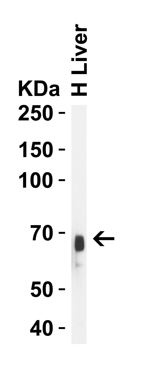 Western Blot: Albumin Antibody - BSA Free [NBP1-77027] - Validation in Human Liver.Loading: 10 ug of lysates per lane.Antibodies: Albumin, , 1 u/mL, 1h incubation at RT in 5% NFDM/TBST.Secondary: Goat anti- chicken IgY HRP conjugate at 1:10000 dilution.