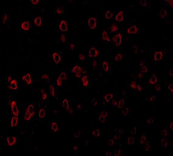 Immunocytochemistry/ Immunofluorescence: SCF/c-kit Ligand Antibody - BSA Free [NBP1-77030] - Immunofluorescence Validation of SCF/c-kit Ligand in Human Brain TissueImmunofluorescent analysis of 4% paraformaldehyde-fixed human brain tissue labeling SCF/c-kit Ligand with  at 20 u/mL, followed by goat anti-rabbit IgG secondary antibody at 1/500 dilution (red).  