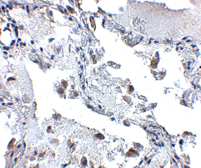 Immunohistochemistry SH3BP4 Antibody - BSA Free