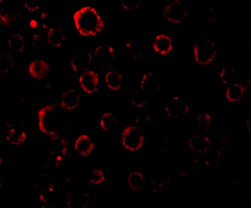 Immunocytochemistry/ Immunofluorescence MADD Antibody - BSA Free