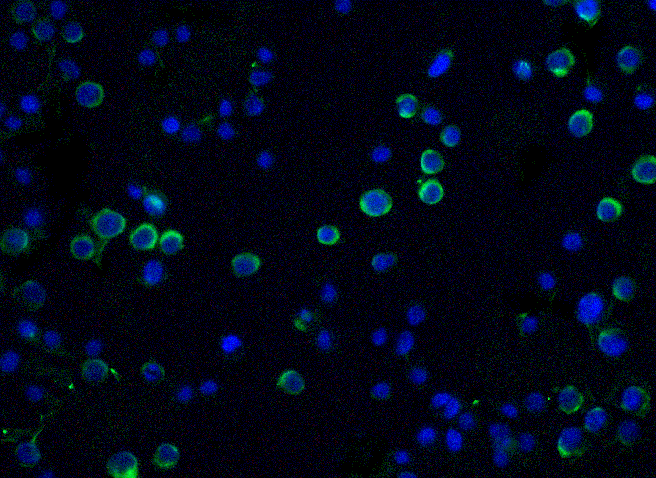 Immunocytochemistry/ Immunofluorescence: DFF45/ICAD Antibody - BSA Free [NBP1-77034] - Immunofluorescence of DFF45/ICAD in Hela cells with DFF45/ICAD antibody at 20 u/mL.Green: DFF45/ICAD Antibody   Blue: DAPI staining