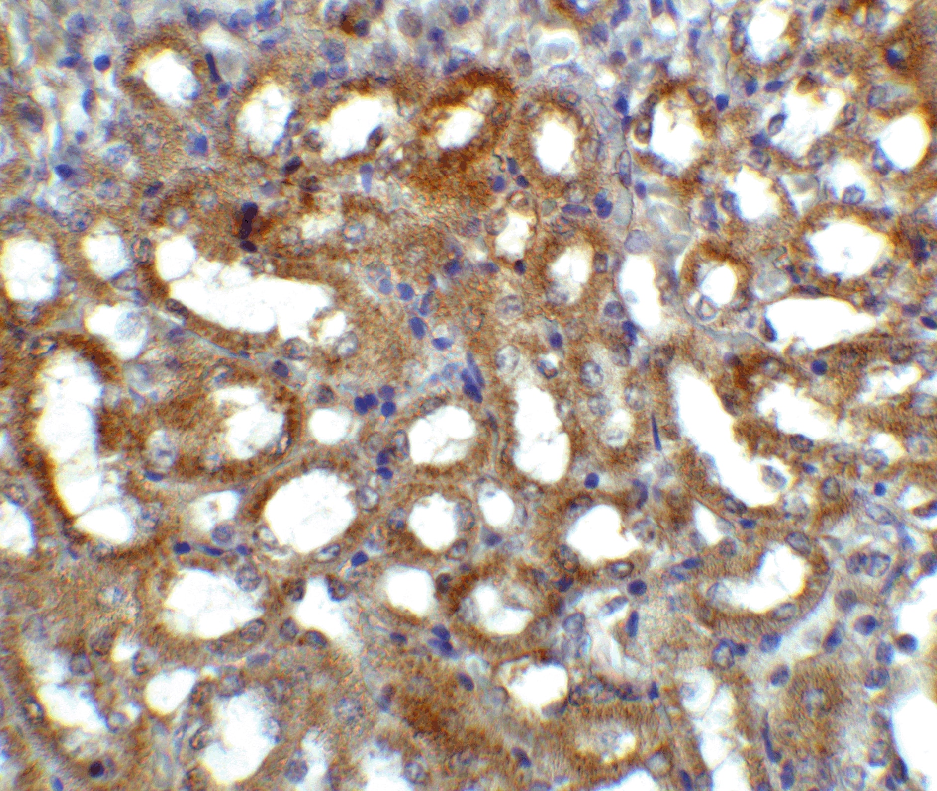 Immunohistochemistry: GFR alpha-3/GDNF R alpha-3 Antibody - BSA Free [NBP1-77035] - Immunohistochemistry of GFR alpha 3 in mouse kidney tissue with GFR alpha 3 antibody at 5 ug/ml.