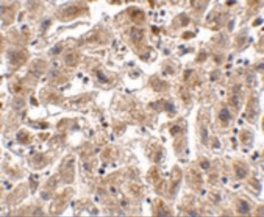 Immunohistochemistry: Occludin Antibody - BSA Free [NBP1-77037] - Immunohistochemistry of Occludin in human liver tissue with Occludin antibody at 2.5 ug/mL.