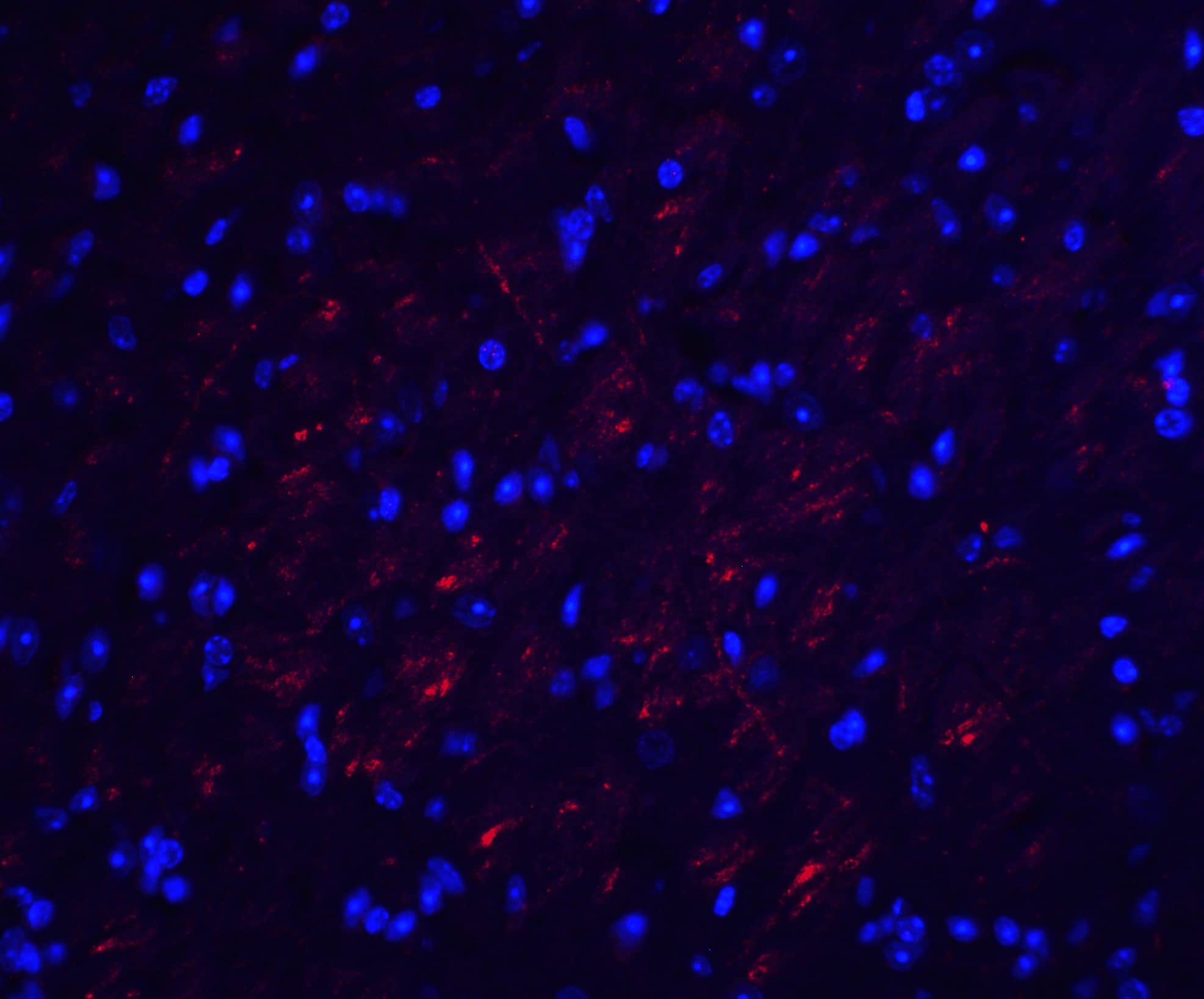 Immunocytochemistry/ Immunofluorescence: Occludin Antibody - BSA Free [NBP1-77037] - Immunofluorescence of Occludin in mouse brain tissue with Occludin antibody at 20 ug/mL.Red: Occludin Antibody   Blue: DAPI staining