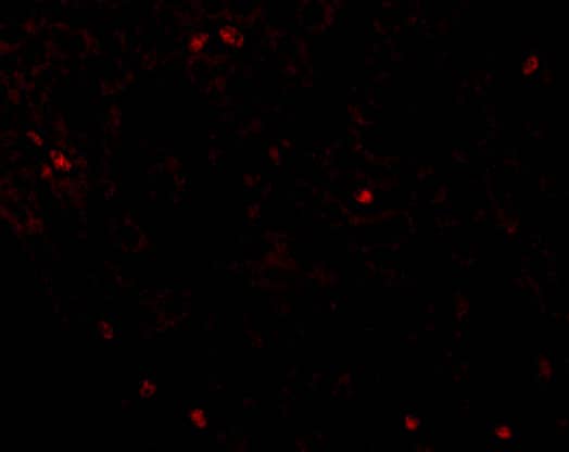 Immunocytochemistry/ Immunofluorescence: Occludin Antibody - BSA Free [NBP1-77037] - Immunofluorescence of Occludin in Human Liver tissue with Occludin antibody at 20 u/mL.