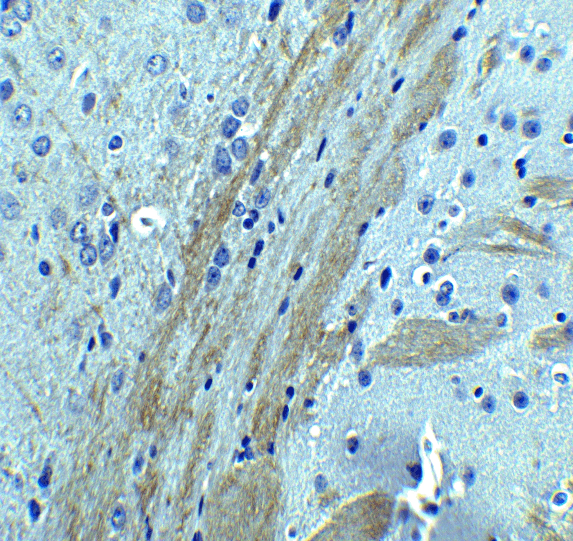 Immunohistochemistry: Occludin Antibody - BSA Free [NBP1-77037] - Immunohistochemistry of Occludin in mouse brain tissue with Occludin Antibody at 5 ug/mL.