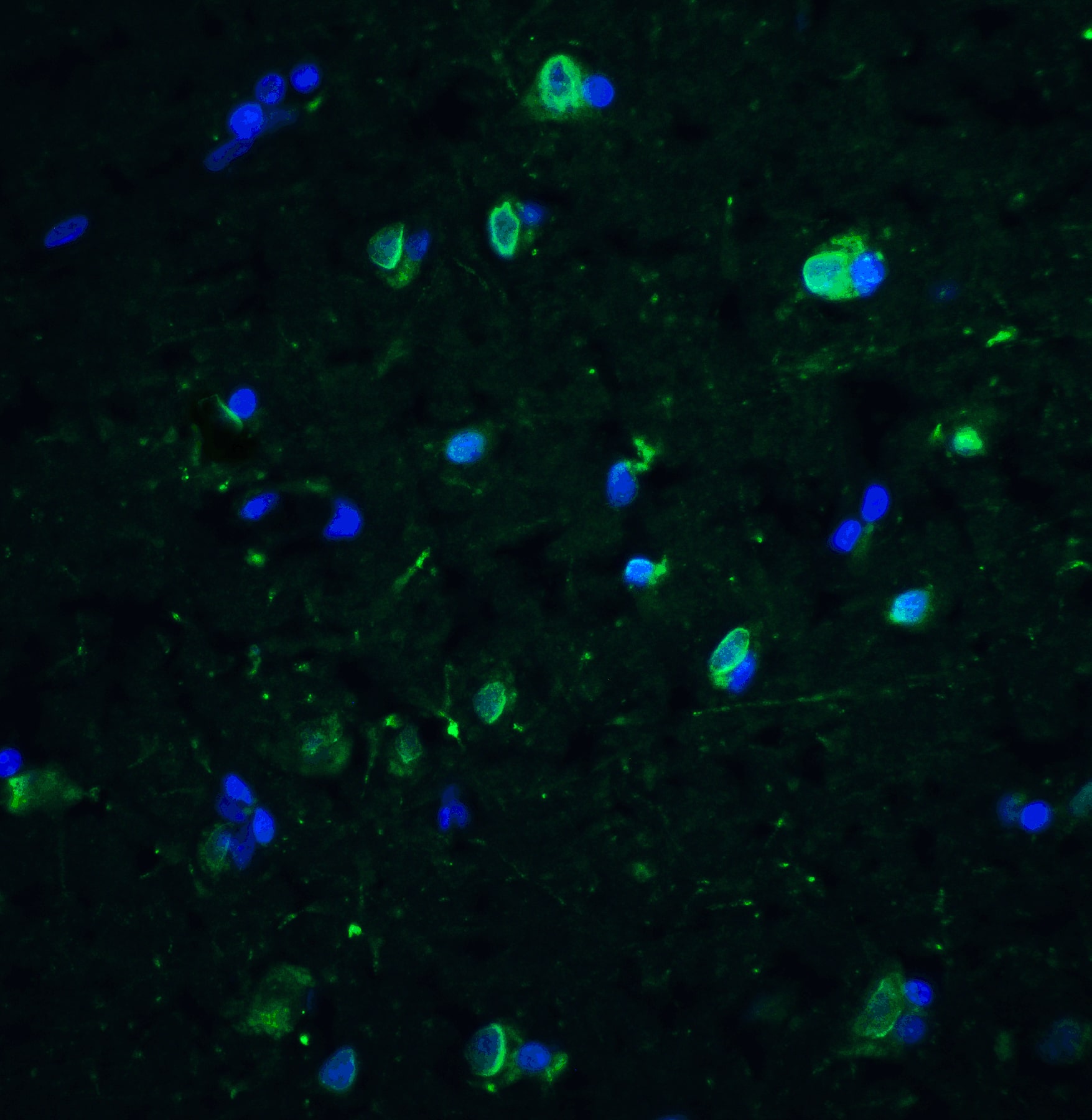 Immunocytochemistry/ Immunofluorescence: CD81 Antibody - BSA Free [NBP1-77039] - Immunofluorescence of CD81 in human brain tissue with CD81 antibody at 10 u/ml.Green: CD81 Antibody   Blue: DAPI staining