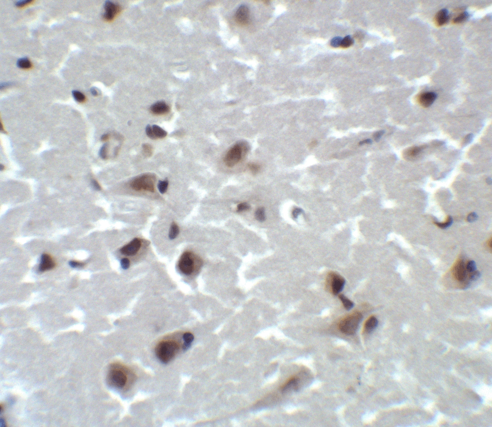 Immunohistochemistry: CD81 Antibody - BSA Free [NBP1-77039] - Immunohistochemistry of CD81 in human brain tissue with CD81 antibody at 2 ug/ml.