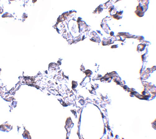 Immunohistochemistry: CD81 Antibody - BSA Free [NBP1-77039] - Immunohistochemistry of CD81 in human lung tissue with CD81 antibody at 5 u/mL.