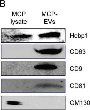  Hebp1 is delivered by MCP-EVs and contributes to nerve regeneration. (A) Representative transmission electron microscopy (TEM) phase images for detecting isolated MCP-EVs. Scale bar = 100 nm. (B) Representative Western blot for Hebp1, EV positive markers (CD63, CD9 and CD81) or EV negative marker (GM130) in MCPs and MCP-EVs. (C, D) Expression of Hebp1 in MCP-EVs infected with lentivirus expressing shHebp1 or shCon at three doses (1 × 103, 5 × 104, and 1 × 104 TU/ml culture medium) for at least 3 days. (E, F) Densitometric quantification of Hebp1 protein bands using an image analyzer. Results are presented as means +/- SEM (n = 4). (G, H) Immunofluorescence staining for NF in mouse MPG tissues exposed to LPS (2.5 μg/ml) and other indicated conditions for 5 days (G). Lengths of NF-positive neurites in MPG tissues, quantified using an image analyzer (H). Results are presented as means +/- SEM (n = 4). Scale bar, 100 um. (I, J) Migration assays of mouse Schwann cells exposed to LPS (2.5 μg/ml) and other indicated conditions for 24 hours (I). Number of migrated cells in the red dotted rectangle, quantified using an image analyzer (J). Results are presented as means +/- SEM (n = 4; **P < 0.01, ***P < 0.001). The relative ratio of the shCon (control) group was defined as 1. MCPs, mouse cavernous pericytes; EVs, extracellular vesicles; LPS, lipopolysaccharide; MPG, major pelvic ganglion; PBS, phosphate-buffered saline; ns, not significant. Image collected and cropped by CiteAb from the following open publication (//pubmed.ncbi.nlm.nih.gov/37324943), licensed under a CC-BY license. Not internally tested by Novus Biologicals.