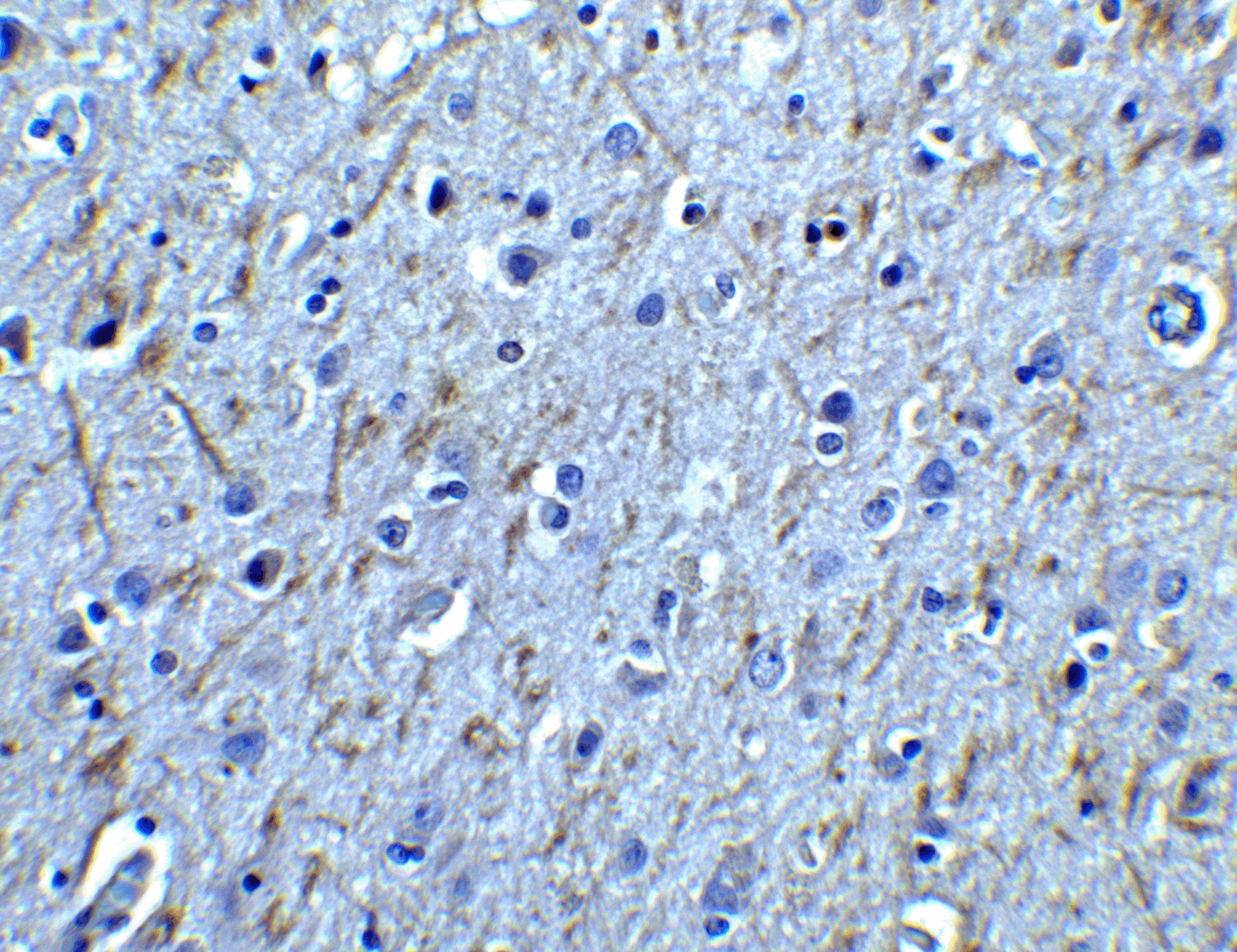 Immunohistochemistry: GFR alpha-1/GDNF R alpha-1 Antibody - BSA Free [NBP1-77043] - Immunohistochemistry of GFR alpha 1 in human brain tissue with GFR alpha 1 antibody at 2.5 ug/ml.